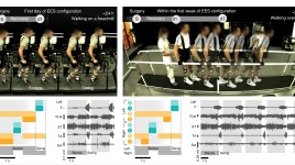 データから動きへ：半身不随の患者を再び歩かせる画期的な方法